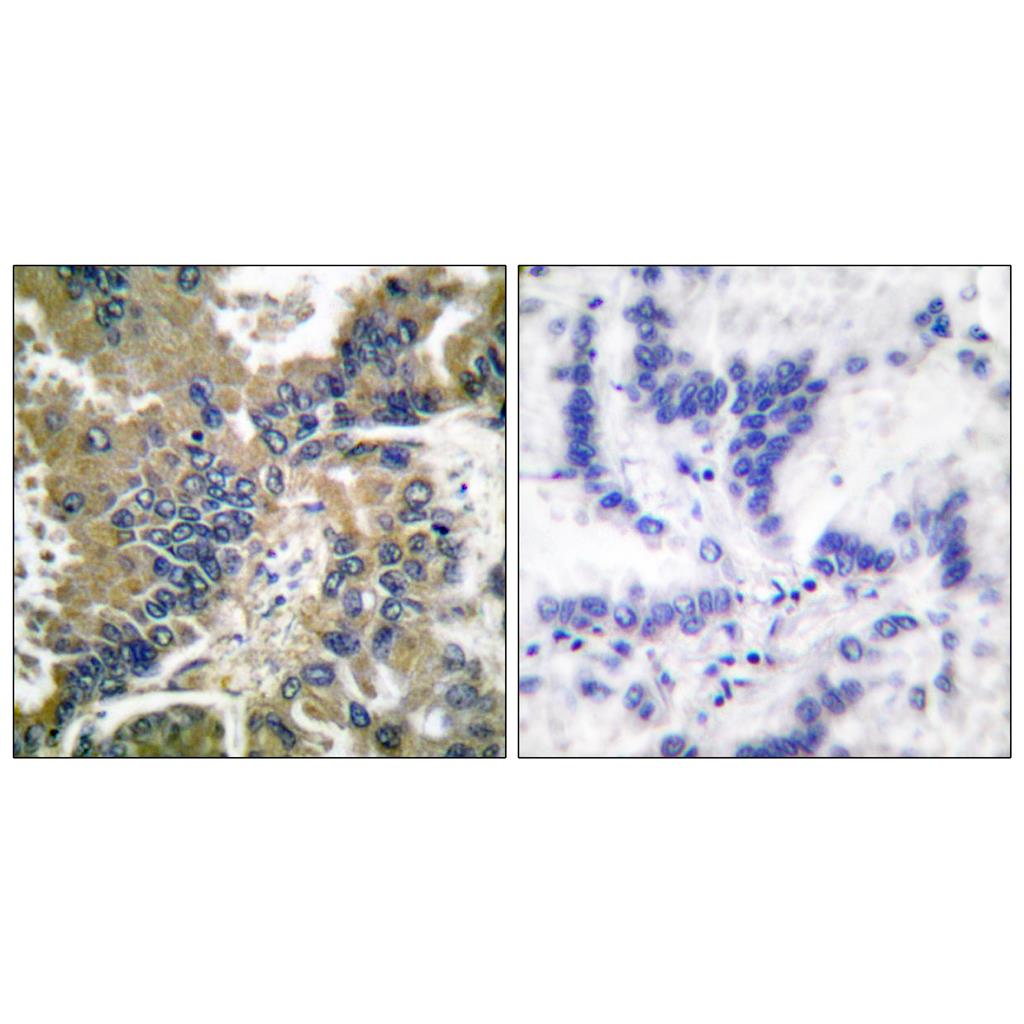 Cleaved-Caspase-1 (D210) Rabbit Polyclonal Antibody | 兔多抗 | EnkiLife恩玑生命