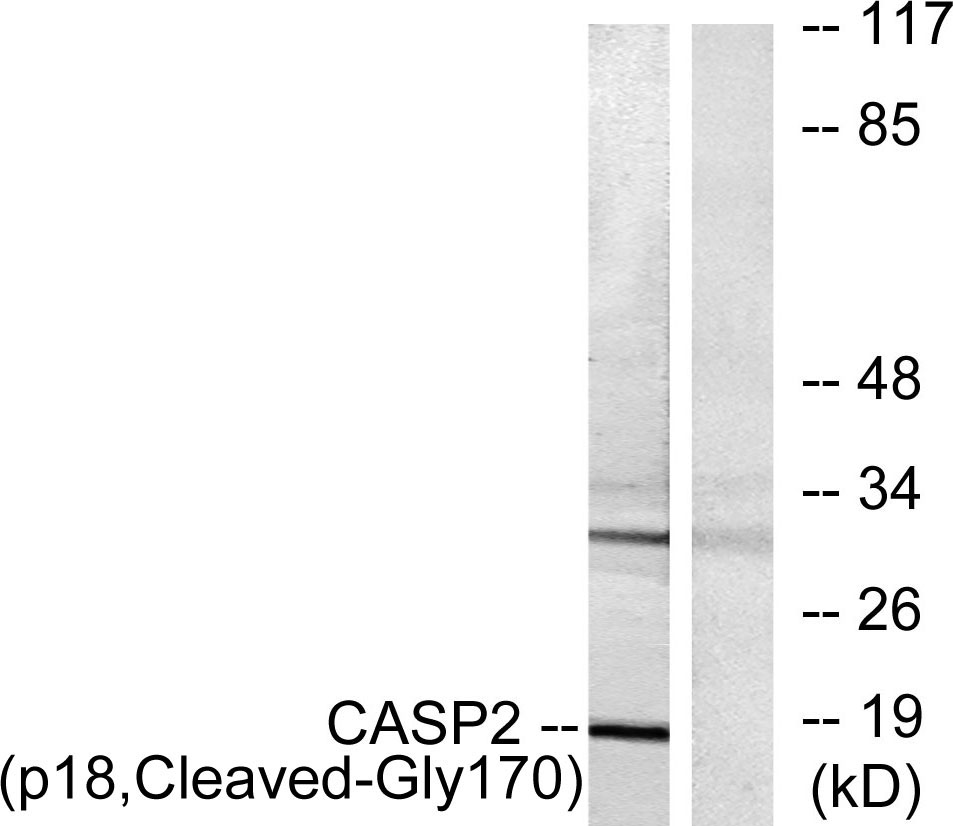 Cleaved-Caspase-2 p18 (G170) Rabbit Polyclonal Antibody | 兔多抗 | EnkiLife恩玑生命