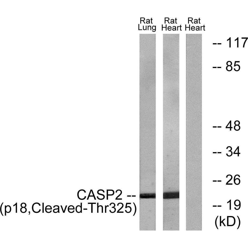 Cleaved-Caspase-2 p18 (T325) Rabbit Polyclonal Antibody | 兔多抗 | EnkiLife恩玑生命