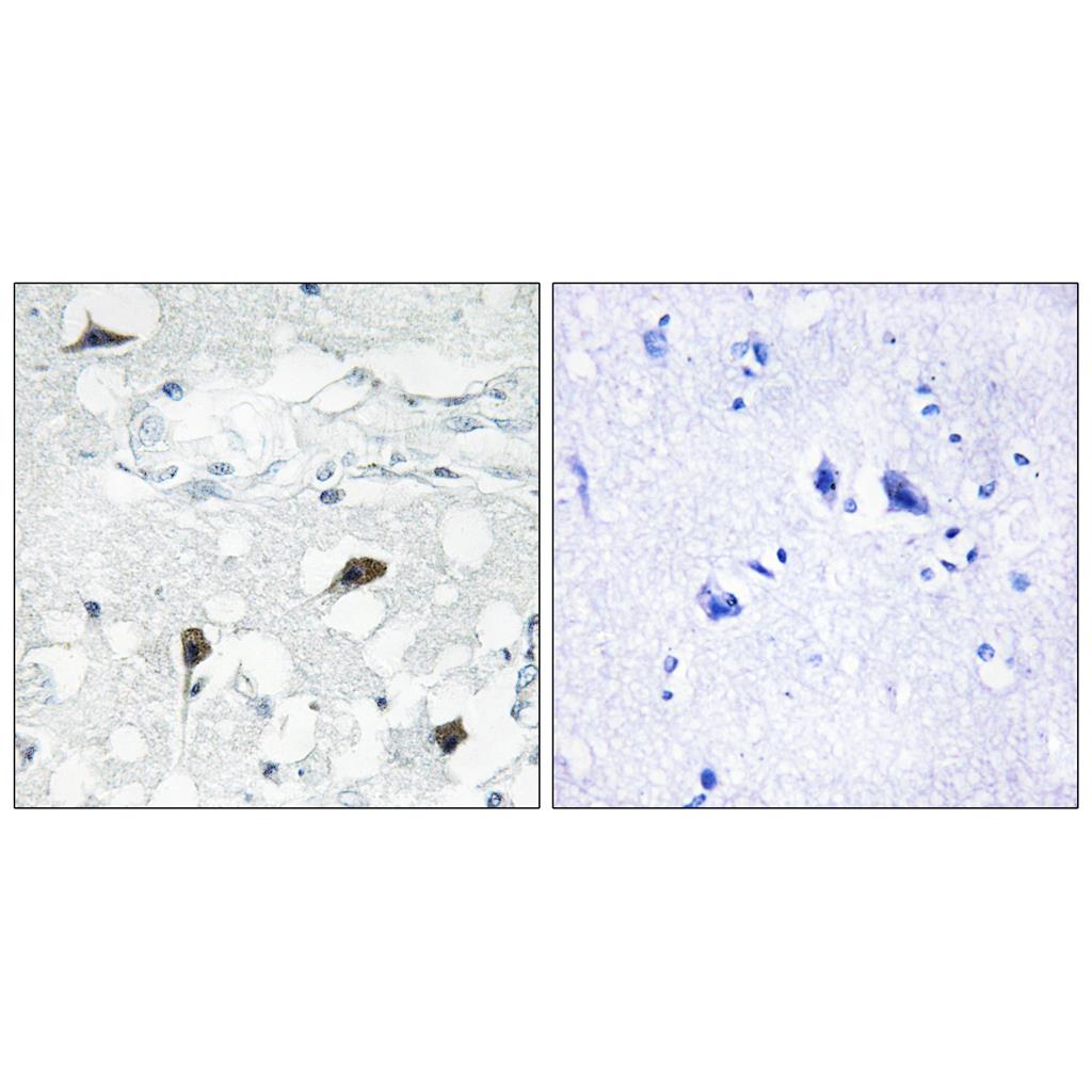 Cleaved-Caspase-3 p12 (D175) Rabbit Polyclonal Antibody | 兔多抗 | EnkiLife恩玑生命