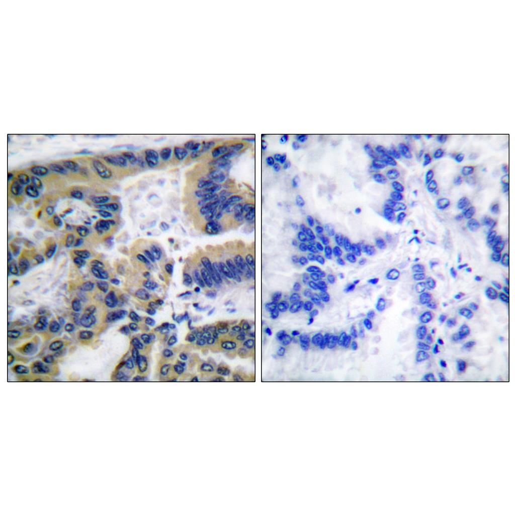 Cleaved-Caspase-7 (S199) Rabbit Polyclonal Antibody | 兔多抗 | EnkiLife恩玑生命