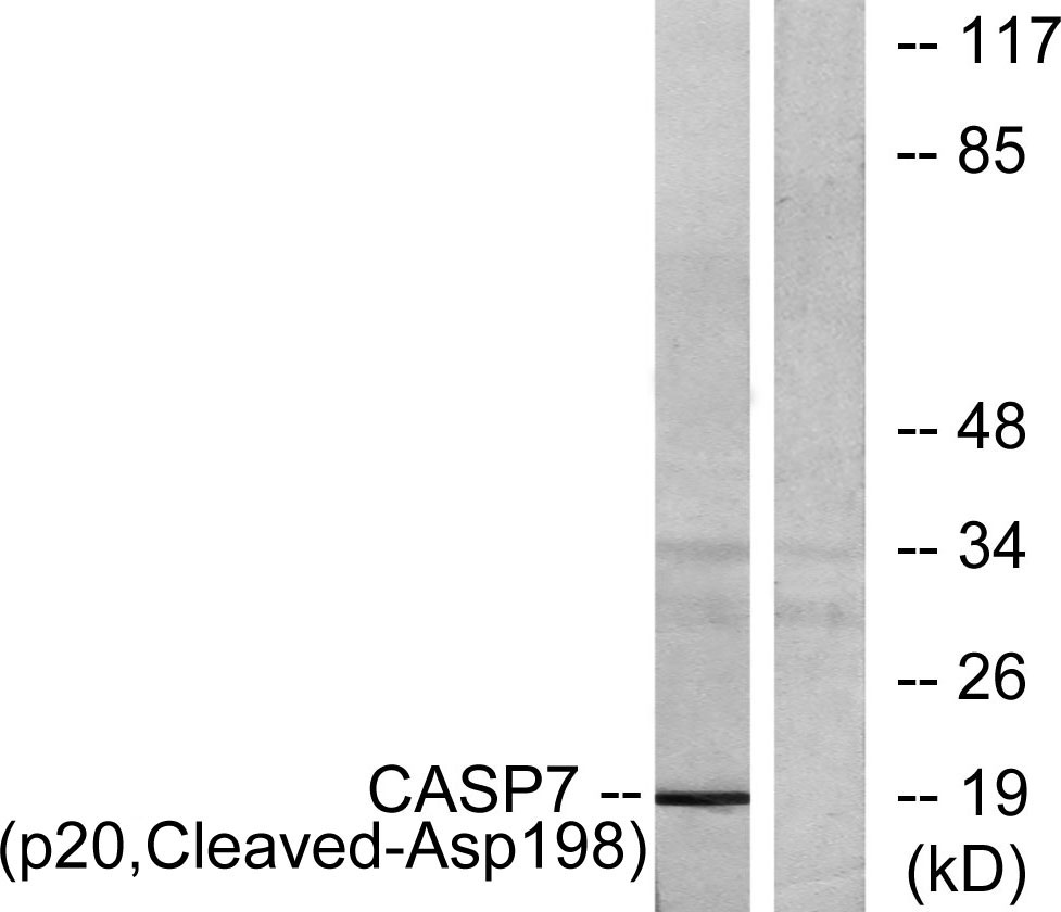 Cleaved-Caspase-7 p20 (D198) Rabbit Polyclonal Antibody | 兔多抗 | EnkiLife恩玑生命
