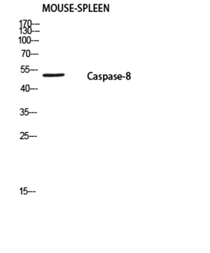 Cleaved-Caspase-8 p18 (S217) Rabbit Polyclonal Antibody | 兔多抗 | EnkiLife恩玑生命