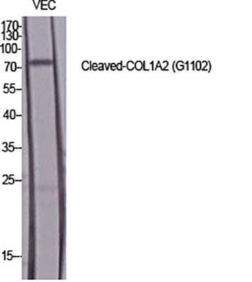 Cleaved-COL1A2 (G1102) Rabbit Polyclonal Antibody | 兔多抗 | EnkiLife恩玑生命