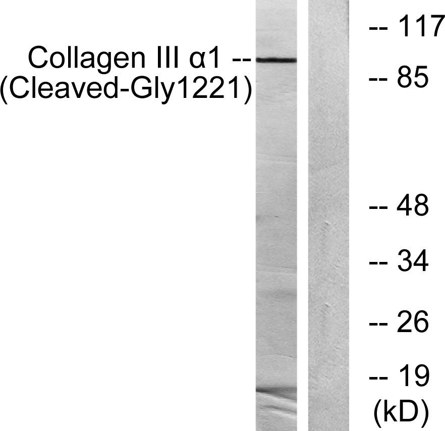Cleaved-COL3A1 (G1221) Rabbit Polyclonal Antibody | 兔多抗 | EnkiLife恩玑生命