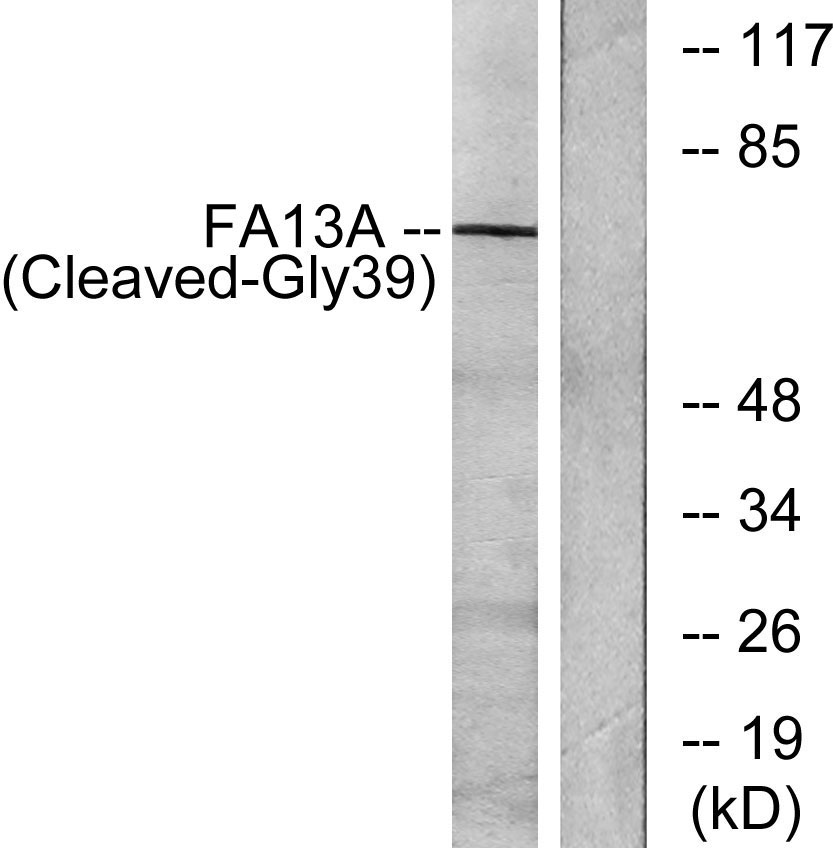 Cleaved-Factor XIIIa (G39) Rabbit Polyclonal Antibody | 兔多抗 | EnkiLife恩玑生命