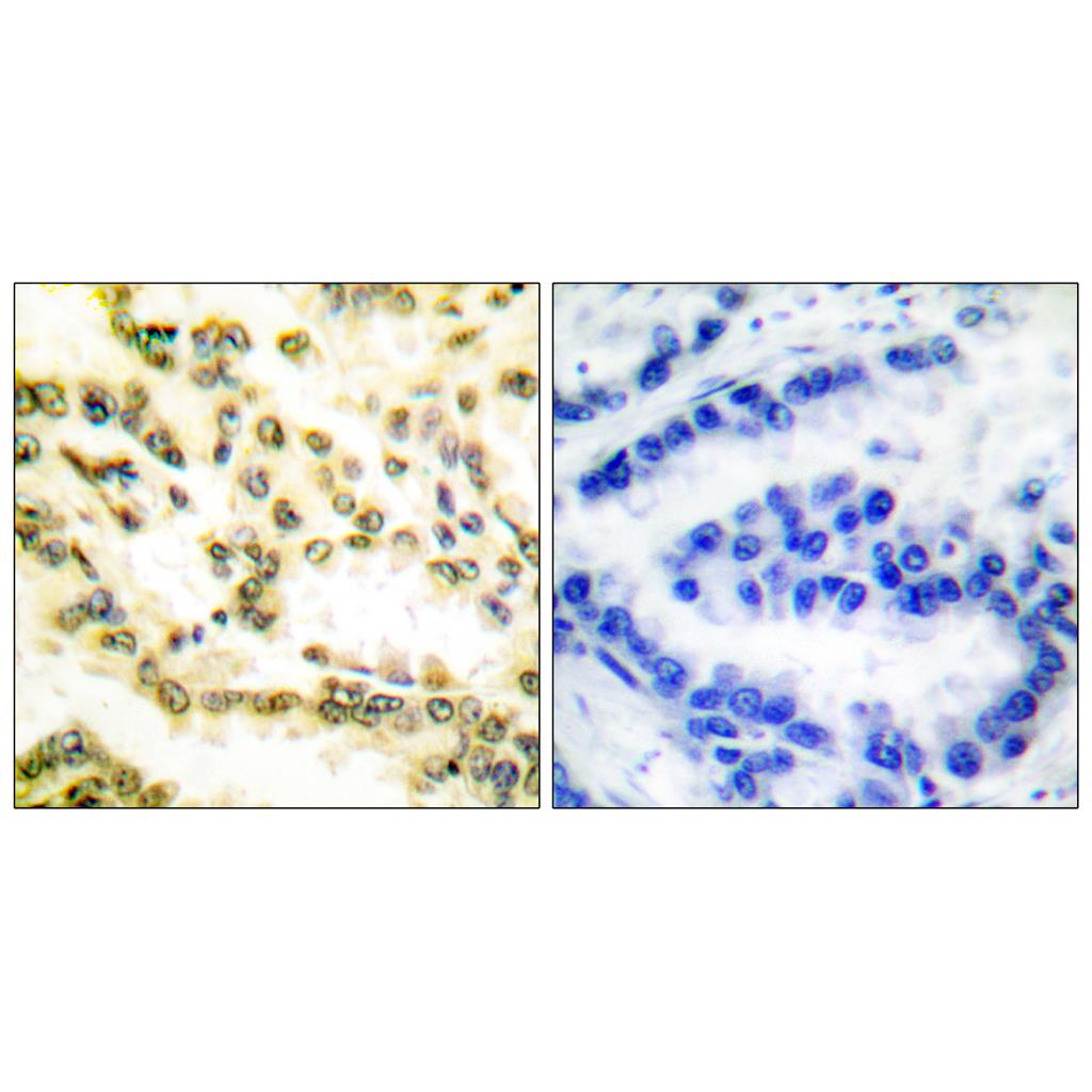Cleaved-Lamin A (D230) Rabbit Polyclonal Antibody | 兔多抗 | EnkiLife恩玑生命