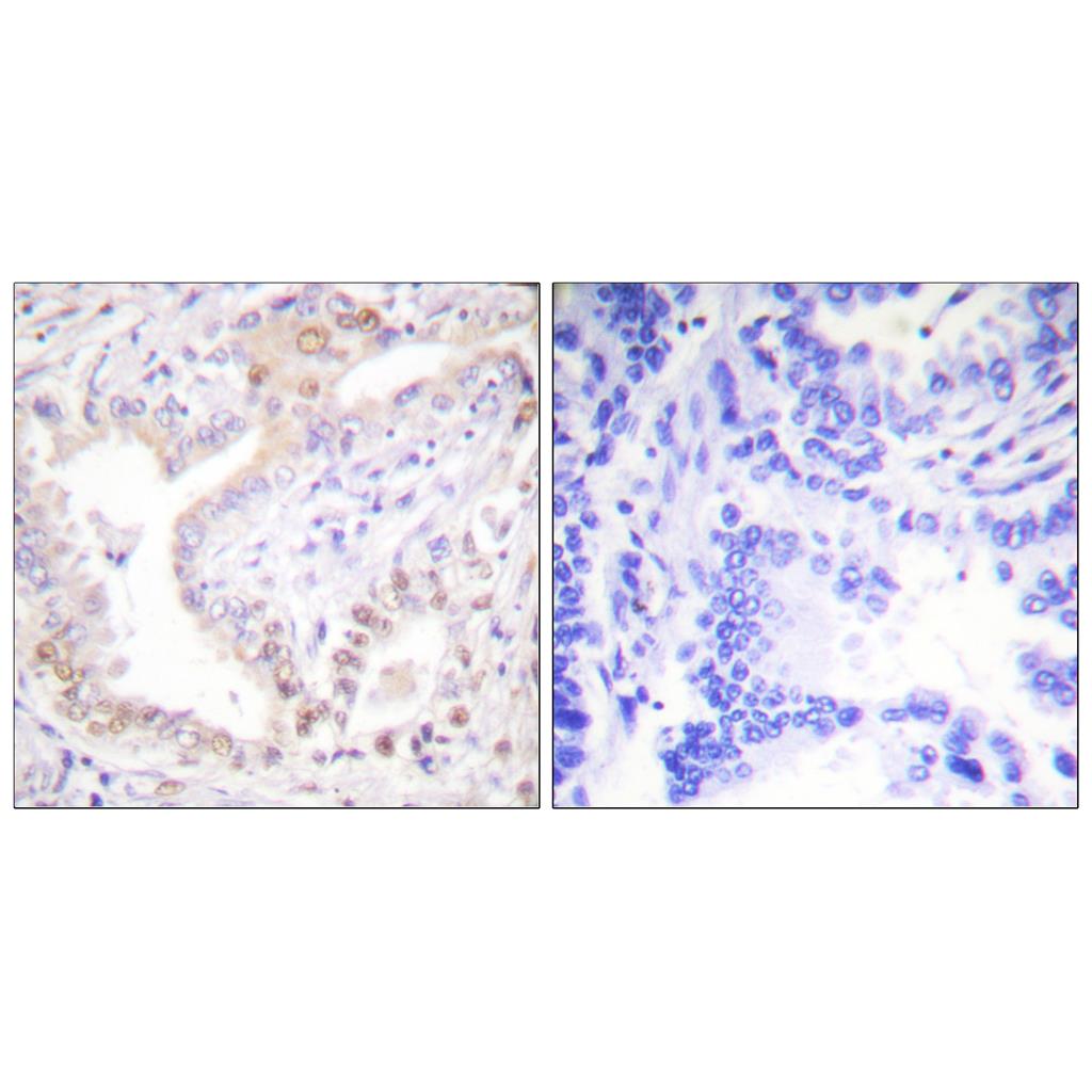 Cleaved-Lamin A (N231) Rabbit Polyclonal Antibody | 兔多抗 | EnkiLife恩玑生命