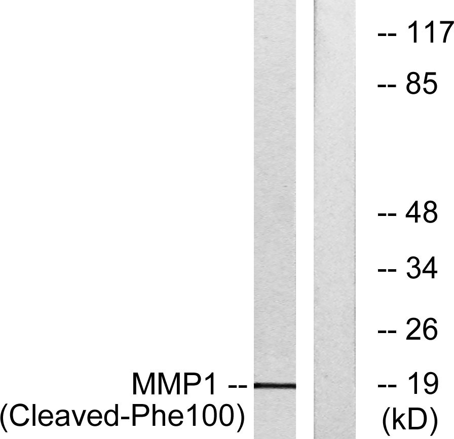 Cleaved-MMP-1 22k (F100) Rabbit Polyclonal Antibody | 兔多抗 | EnkiLife恩玑生命