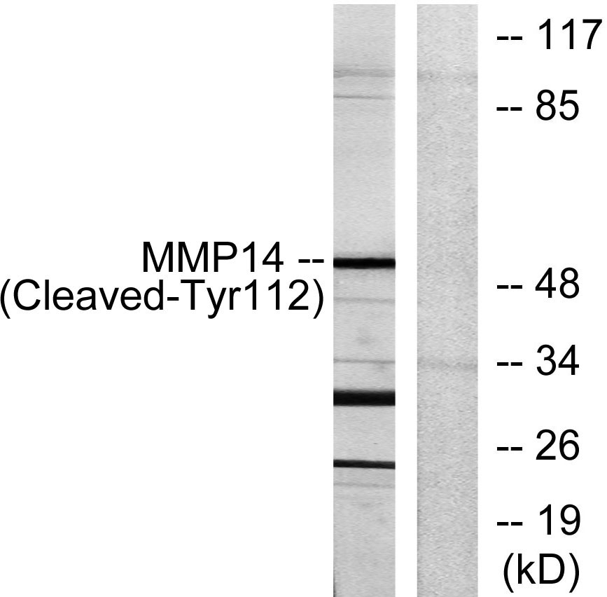 Cleaved-MMP-14 (Y112) Rabbit Polyclonal Antibody | 兔多抗 | EnkiLife恩玑生命