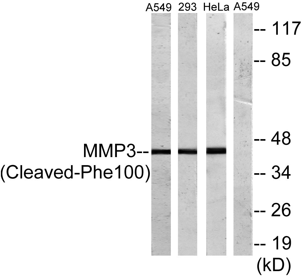 Cleaved-MMP-3 (F100) Rabbit Polyclonal Antibody | 兔多抗 | EnkiLife恩玑生命