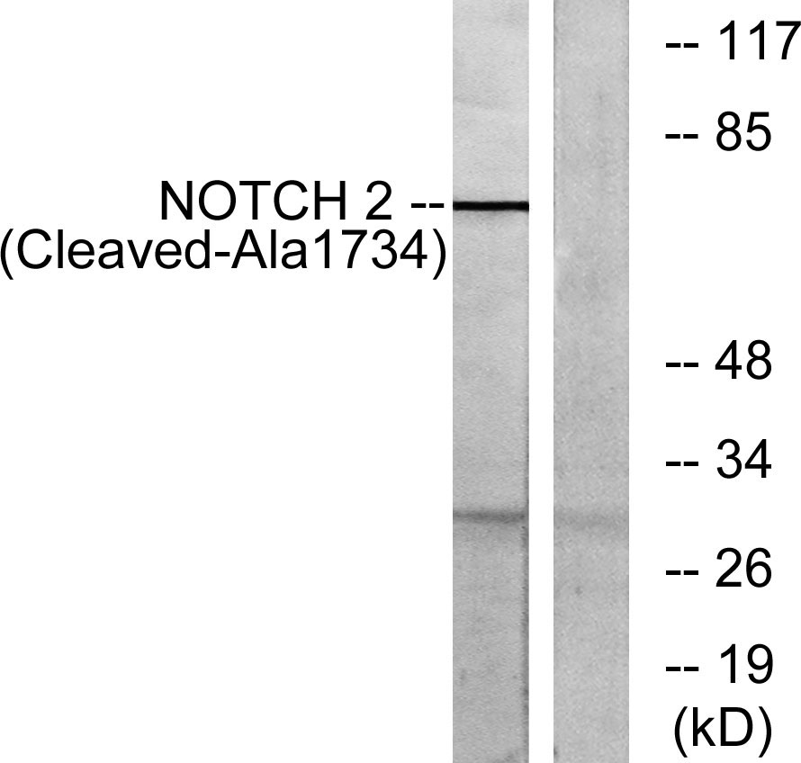 Cleaved-Notch 2 (A1734) Rabbit Polyclonal Antibody | 兔多抗 | EnkiLife恩玑生命