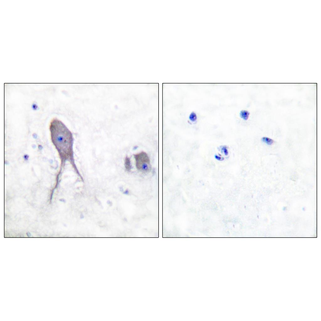 Cleaved-Notch 2 (D1733) Rabbit Polyclonal Antibody | 兔多抗 | EnkiLife恩玑生命
