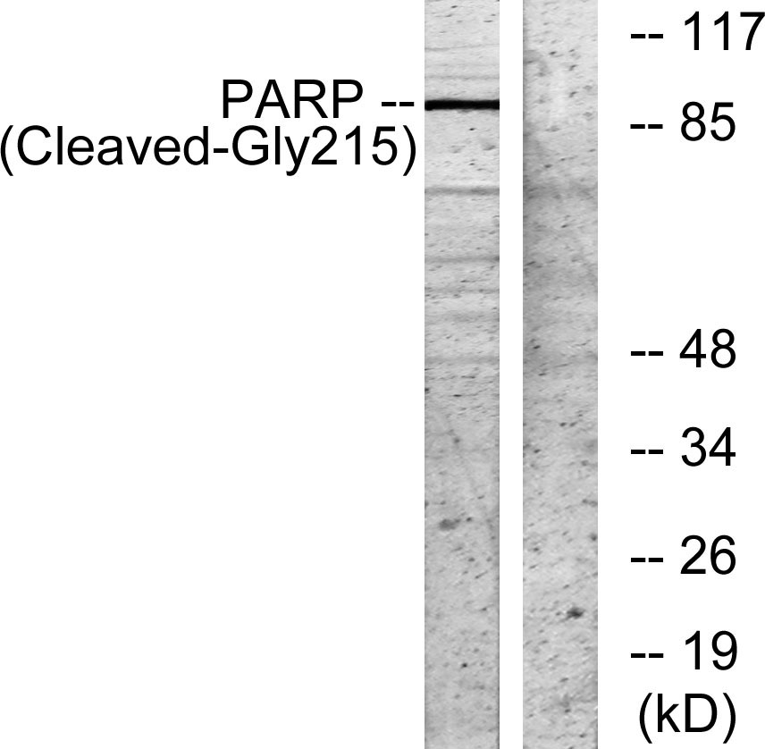 Cleaved-PARP-1 (G215) Rabbit Polyclonal Antibody | 兔多抗 | EnkiLife恩玑生命