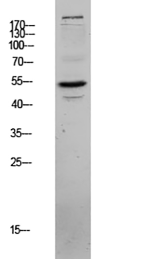 CLUS Rabbit Polyclonal Antibody | 兔多抗 | EnkiLife恩玑生命