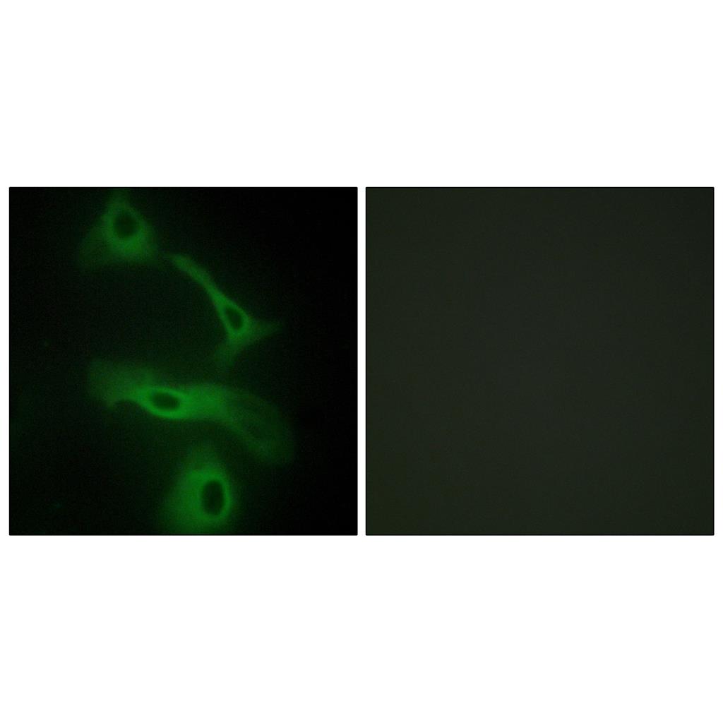 Clusterin Rabbit Polyclonal Antibody | 兔多抗 | EnkiLife恩玑生命