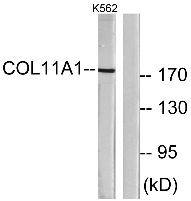 COL11A1 Rabbit Polyclonal Antibody | 兔多抗 | EnkiLife恩玑生命