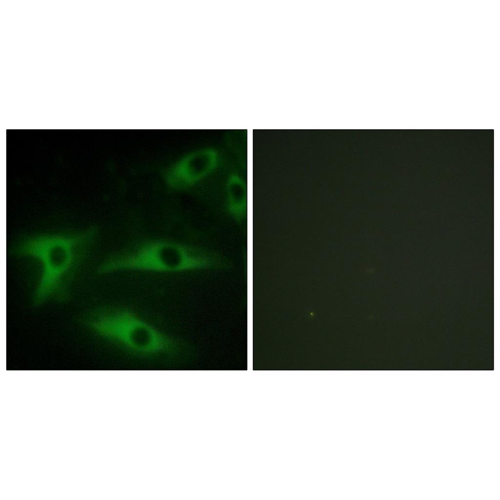COL1A2 Rabbit Polyclonal Antibody | 兔多抗 | EnkiLife恩玑生命
