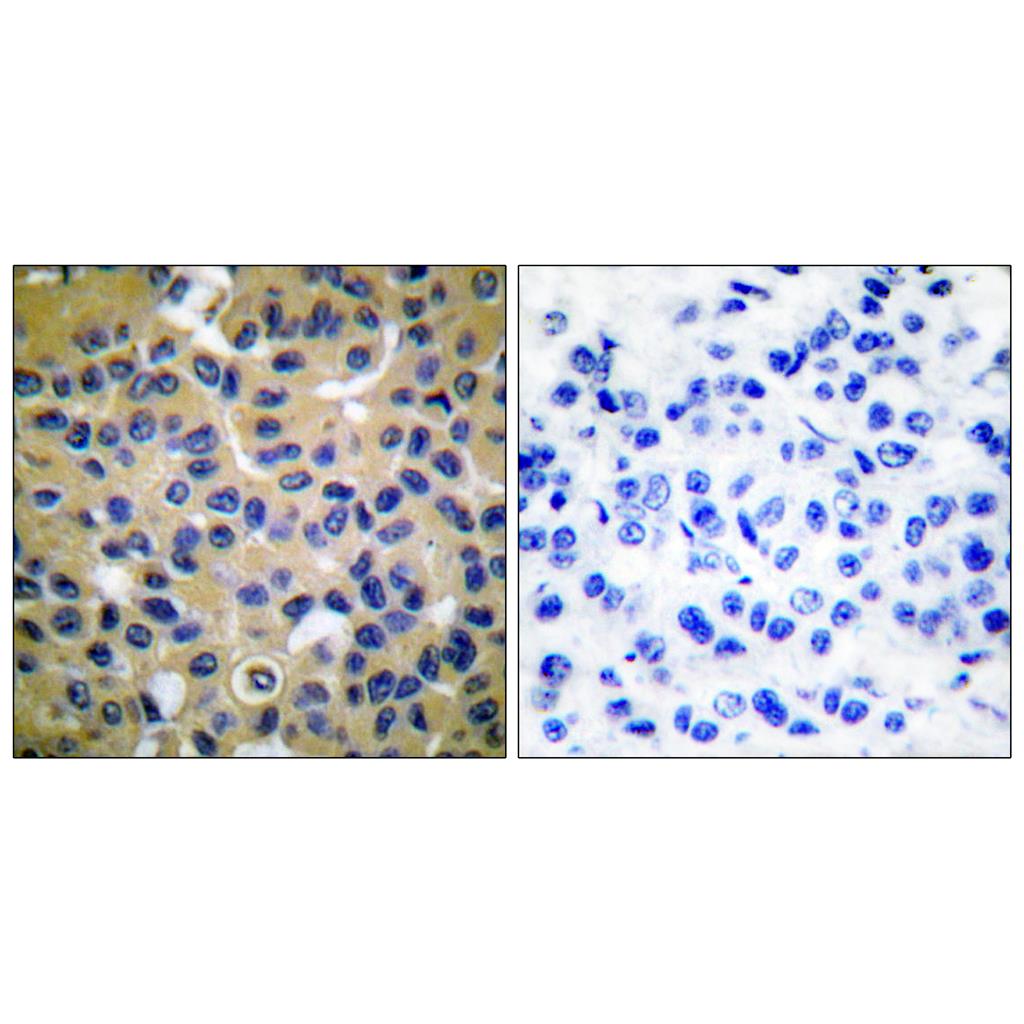 COL2A1 Rabbit Polyclonal Antibody | 兔多抗 | EnkiLife恩玑生命