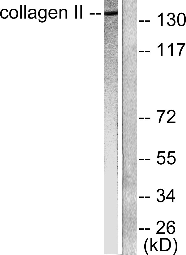 COL2A1 Rabbit Polyclonal Antibody | 兔多抗 | EnkiLife恩玑生命