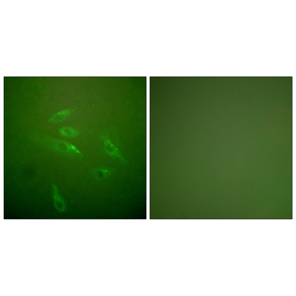 COL3A1 Rabbit Polyclonal Antibody | 兔多抗 | EnkiLife恩玑生命
