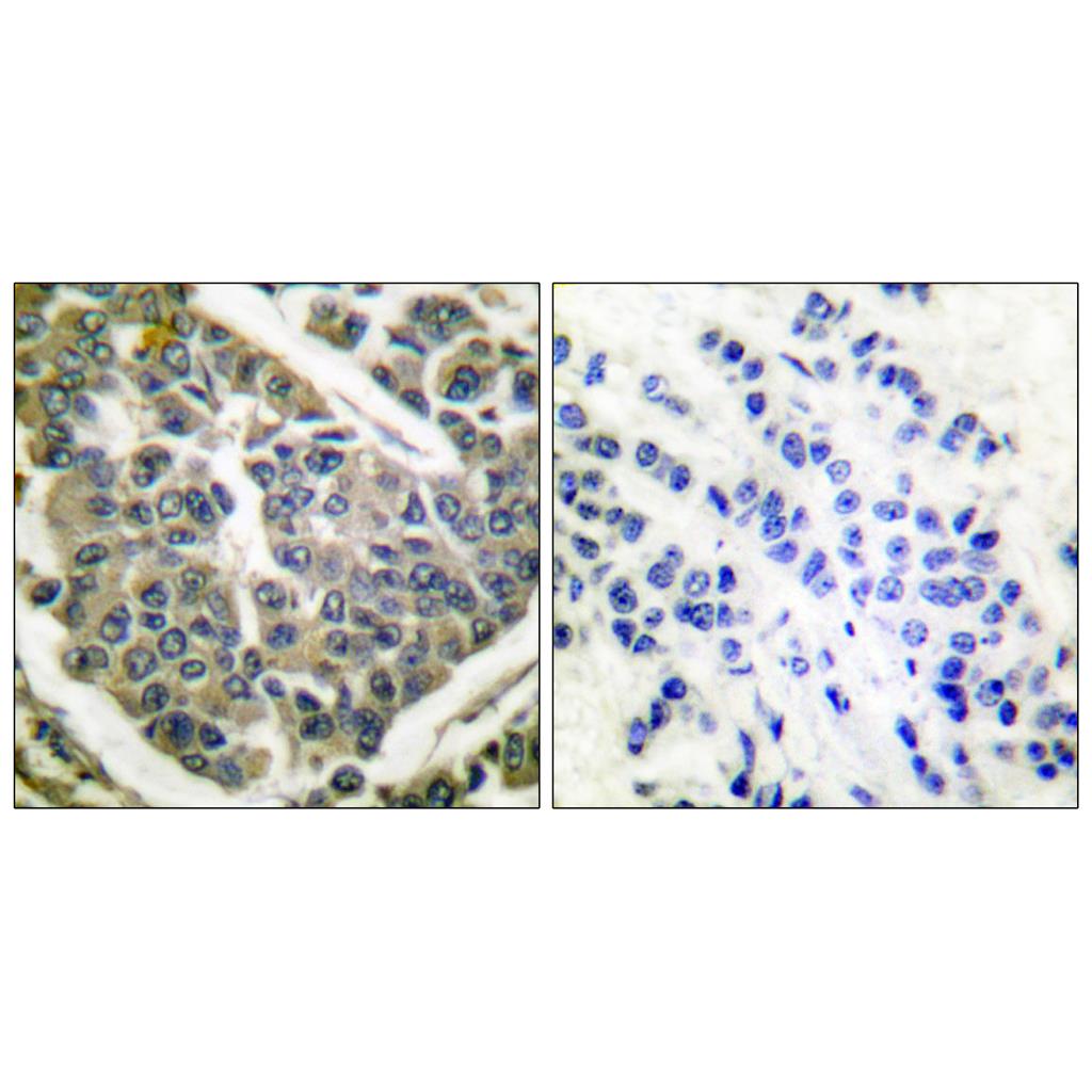 COL4A1 Rabbit Polyclonal Antibody | 兔多抗 | EnkiLife恩玑生命