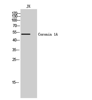 Coronin 1A Rabbit Polyclonal Antibody | 兔多抗 | EnkiLife恩玑生命