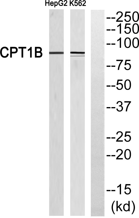 CPTI-M Rabbit Polyclonal Antibody | 兔多抗 | EnkiLife恩玑生命