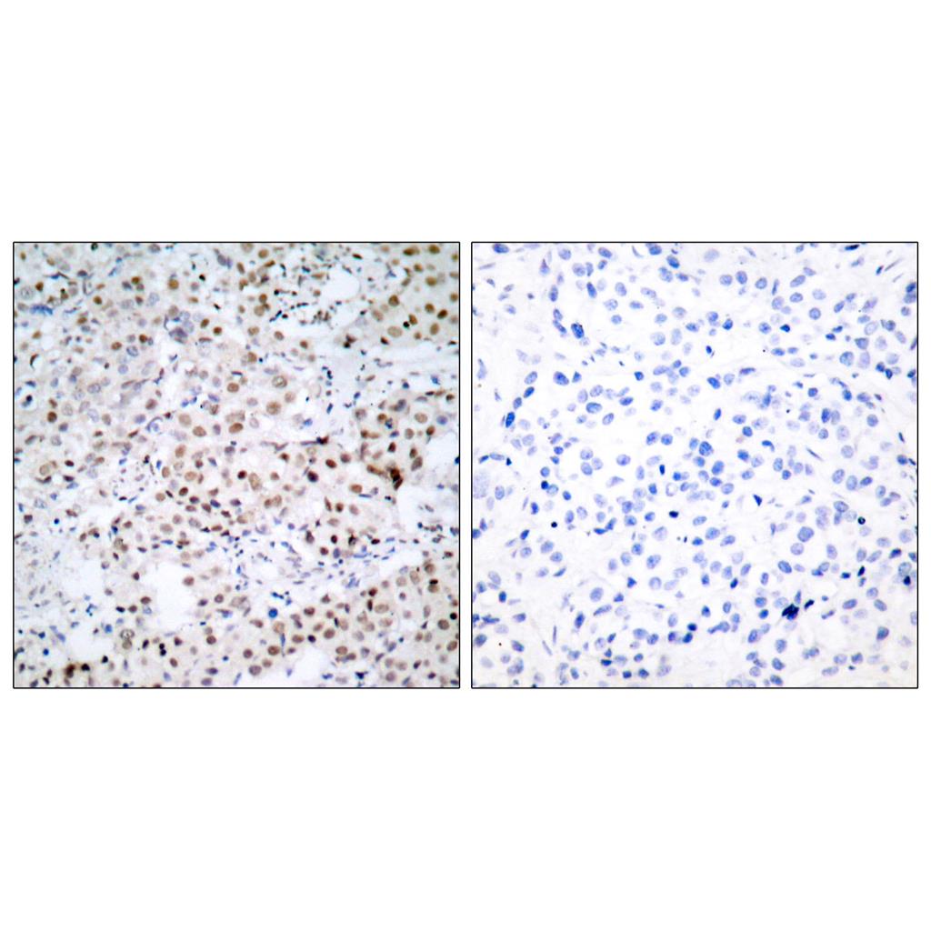CREB-1 Rabbit Polyclonal Antibody | 兔多抗 | EnkiLife恩玑生命