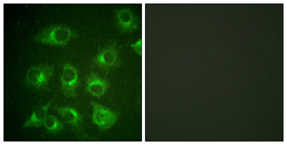 Crk II Rabbit Polyclonal Antibody | 兔多抗 | EnkiLife恩玑生命