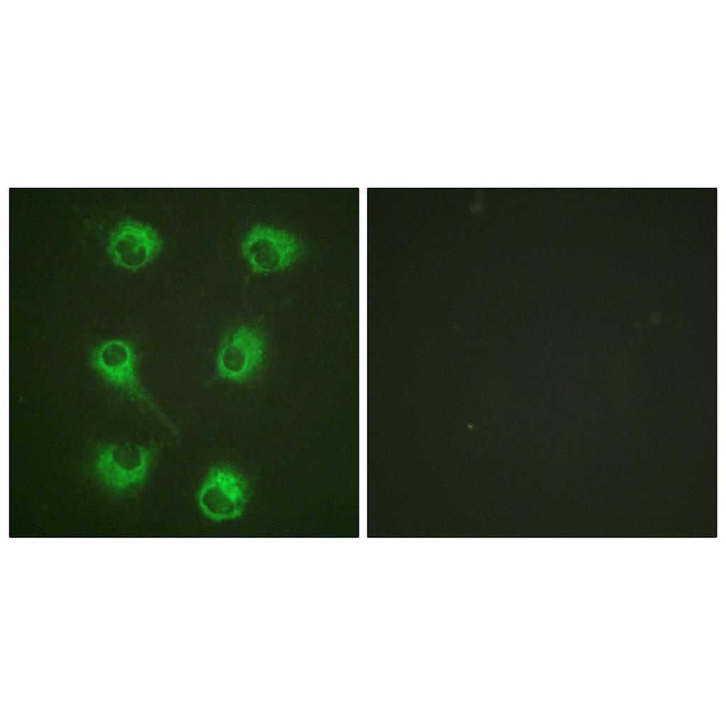 Crk-L Rabbit Polyclonal Antibody | 兔多抗 | EnkiLife恩玑生命