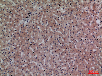 CRP Rabbit Polyclonal Antibody | 兔多抗 | EnkiLife恩玑生命