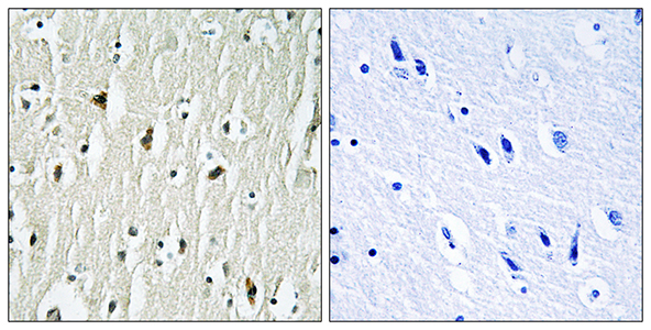 Csk Rabbit Polyclonal Antibody | 兔多抗 | EnkiLife恩玑生命