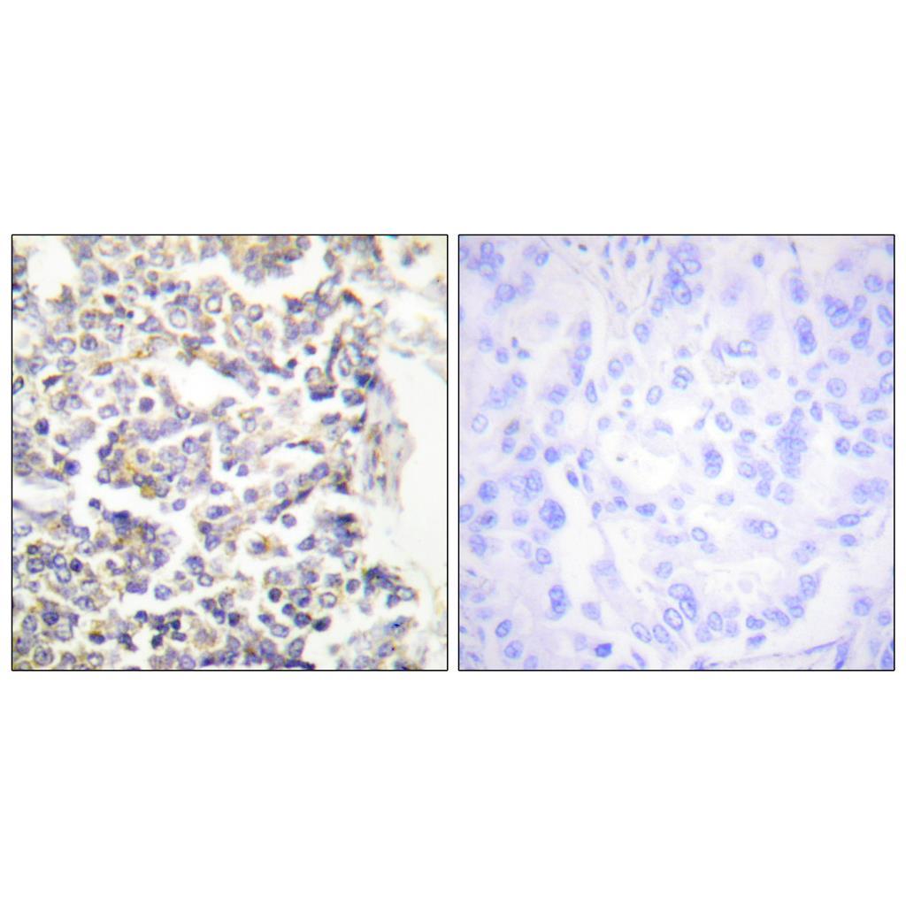 C-TAK1 Rabbit Polyclonal Antibody | 兔多抗 | EnkiLife恩玑生命