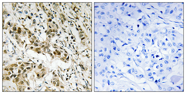 CtBP1 Rabbit Polyclonal Antibody | 兔多抗 | EnkiLife恩玑生命