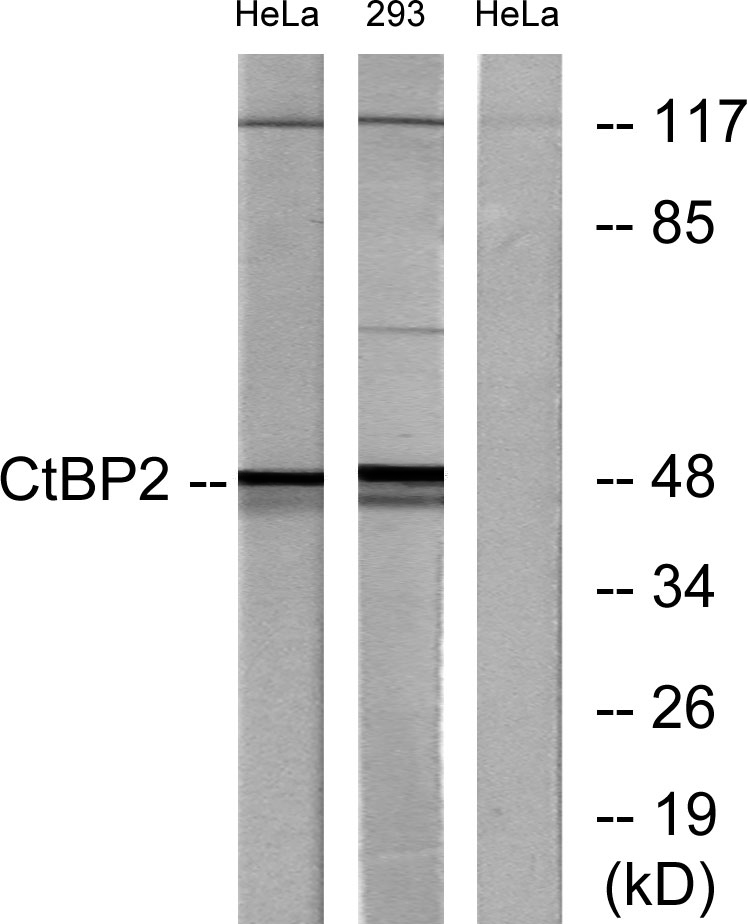 CtBP2 Rabbit Polyclonal Antibody | 兔多抗 | EnkiLife恩玑生命