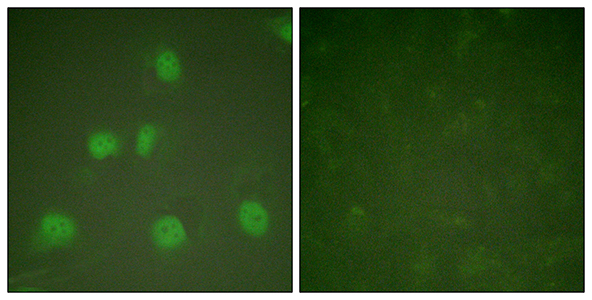 CUL-1 Rabbit Polyclonal Antibody | 兔多抗 | EnkiLife恩玑生命