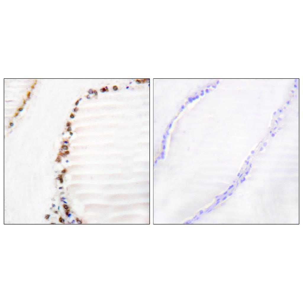 CUL-3 Rabbit Polyclonal Antibody | 兔多抗 | EnkiLife恩玑生命