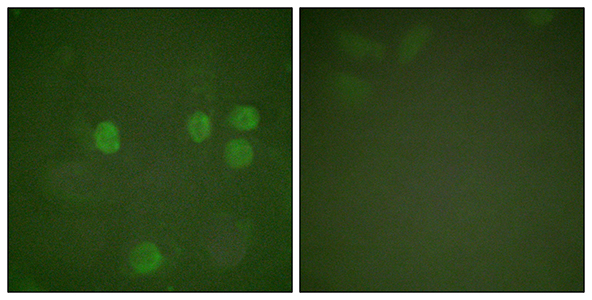 Cyclin B1 Rabbit Polyclonal Antibody | 兔多抗 | EnkiLife恩玑生命