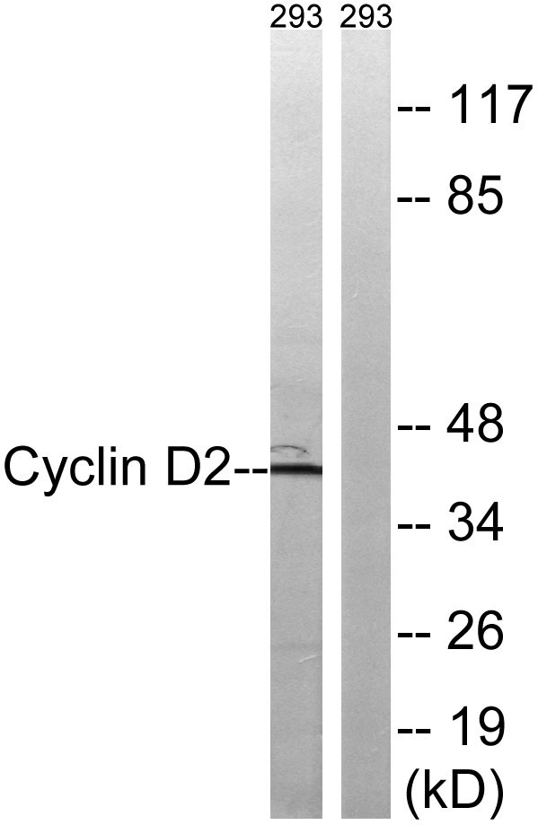 Cyclin D2 Rabbit Polyclonal Antibody | 兔多抗 | EnkiLife恩玑生命