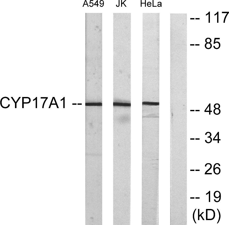 CYP17A1 Rabbit Polyclonal Antibody | 兔多抗 | EnkiLife恩玑生命