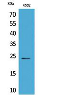 CyPB Rabbit Polyclonal Antibody | 兔多抗 | EnkiLife恩玑生命