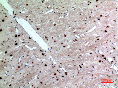 Cytokeratin 14 Rabbit Polyclonal Antibody | 兔多抗 | EnkiLife恩玑生命