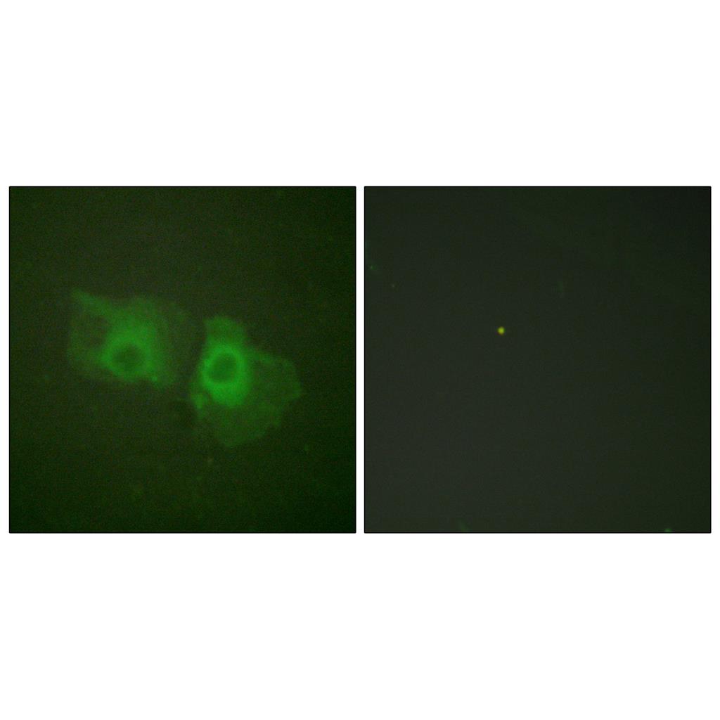 Cytokeratin 18 Rabbit Polyclonal Antibody | 兔多抗 | EnkiLife恩玑生命