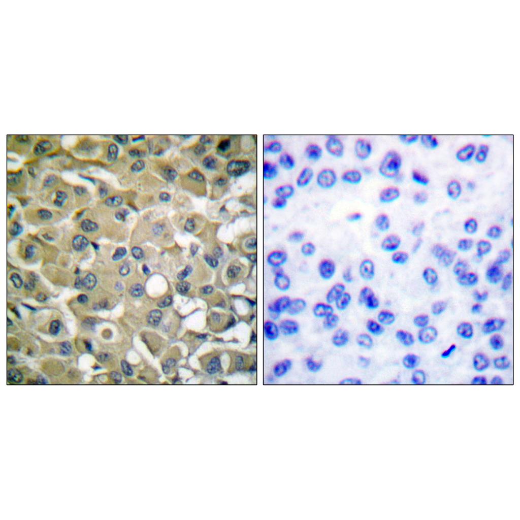 Cytokeratin 18 Rabbit Polyclonal Antibody | 兔多抗 | EnkiLife恩玑生命