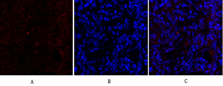 Cytokeratin 18 Rabbit Polyclonal Antibody | 兔多抗 | EnkiLife恩玑生命