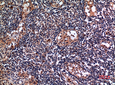 Cytokeratin 19 Rabbit Polyclonal Antibody | 兔多抗 | EnkiLife恩玑生命