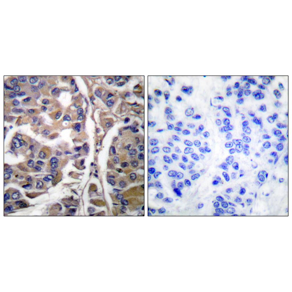 Cytokeratin 20 Rabbit Polyclonal Antibody | 兔多抗 | EnkiLife恩玑生命