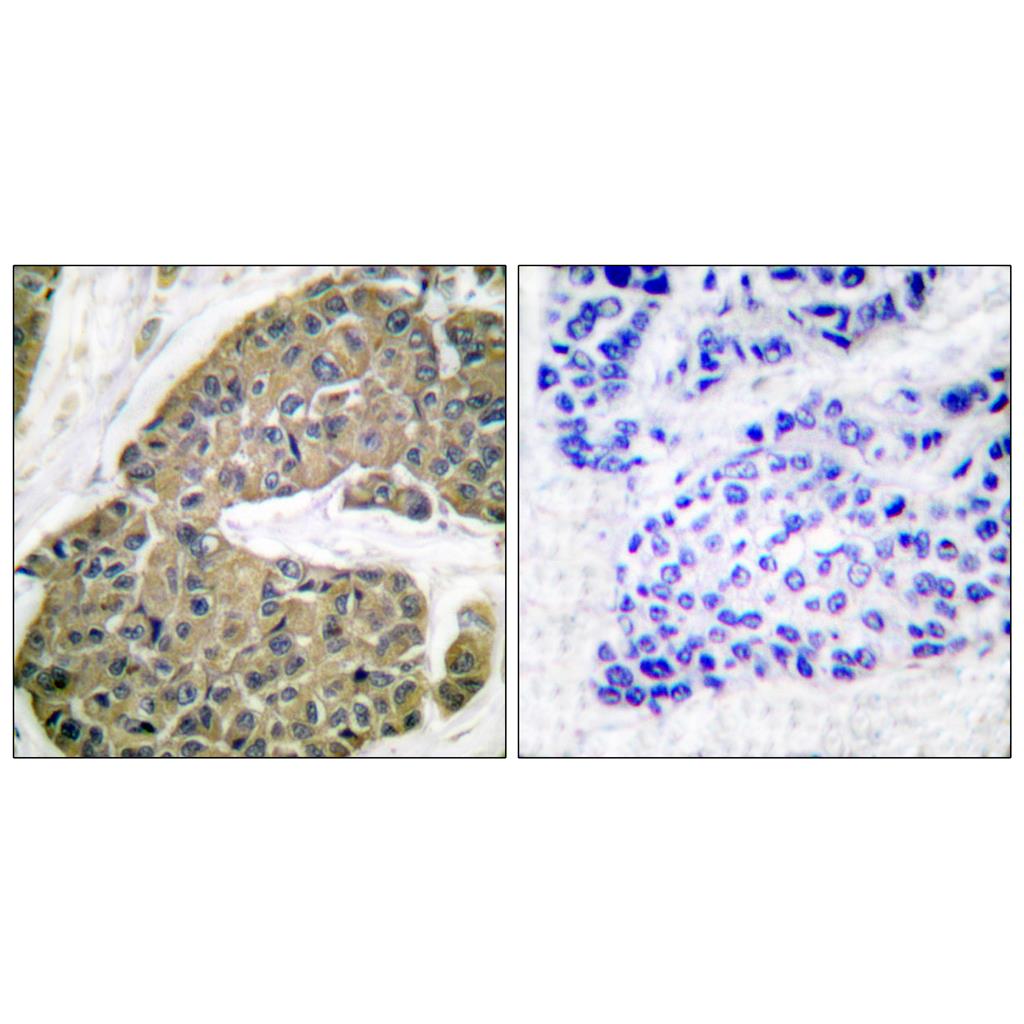 Cytokeratin 5 Rabbit Polyclonal Antibody | 兔多抗 | EnkiLife恩玑生命