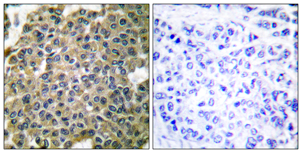 Cytokeratin 7 Rabbit Polyclonal Antibody | 兔多抗 | EnkiLife恩玑生命